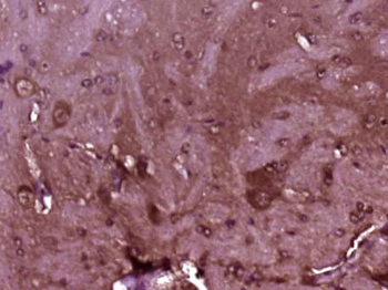 CDC37 Rabbit Polyclonal Antibody