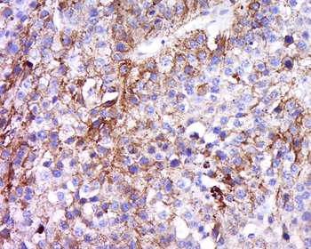 MAGEA5 Rabbit Polyclonal Antibody