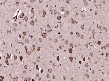 SPON1 Rabbit Polyclonal Antibody
