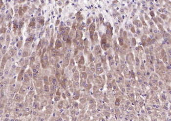 TNFAIP3 interacting protein 3 Rabbit Polyclonal Antibody