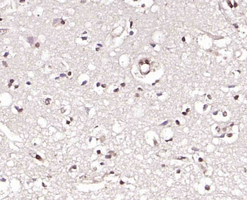ZHX2 Rabbit Polyclonal Antibody