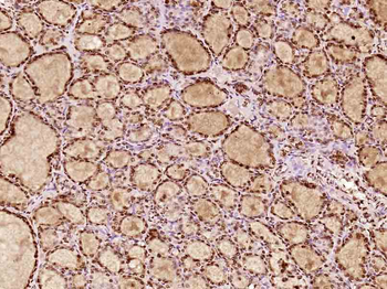 ZHX2 Rabbit Polyclonal Antibody