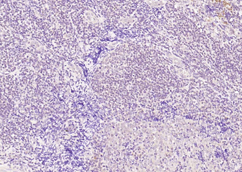 CAPG2 Rabbit Polyclonal Antibody