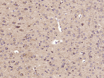 ABCG1 Rabbit Polyclonal Antibody