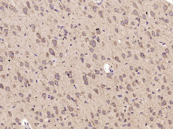 ABCG1 Rabbit Polyclonal Antibody