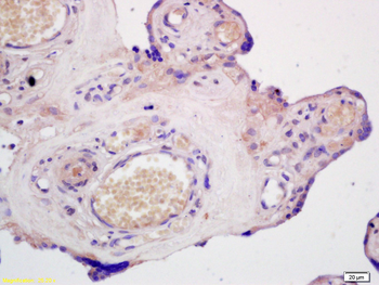 ABCG1 Rabbit Polyclonal Antibody