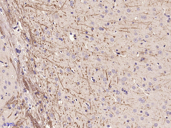 ABCG4 Rabbit Polyclonal Antibody