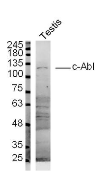 C-Abl Rabbit Polyclonal Antibody