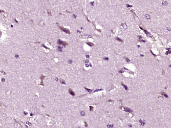 ARHGAP20 Rabbit Polyclonal Antibody