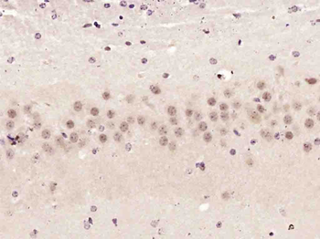CCDC106 Rabbit Polyclonal Antibody