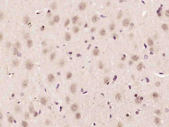 CCDC106 Rabbit Polyclonal Antibody