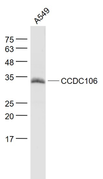 CCDC106 Rabbit Polyclonal Antibody