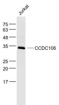 CCDC106 Rabbit Polyclonal Antibody