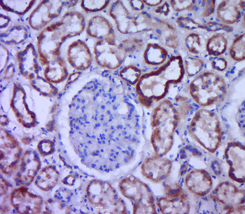 ACE Rabbit Polyclonal Antibody