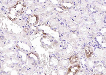 MGAT5 Rabbit Polyclonal Antibody
