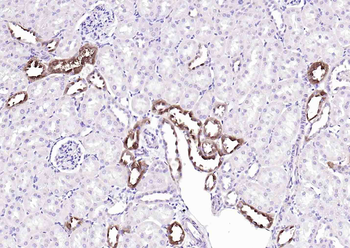 MGAT5 Rabbit Polyclonal Antibody
