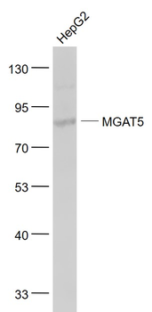 MGAT5 Rabbit Polyclonal Antibody