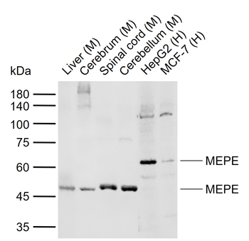 MEPE Rabbit Polyclonal Antibody