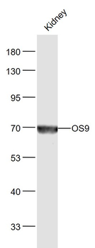 OS9 Rabbit Polyclonal Antibody