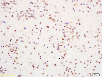 YB1 Rabbit Polyclonal Antibody