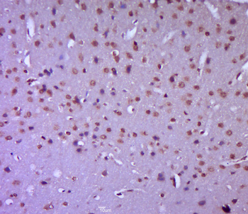 Plzf Rabbit Polyclonal Antibody