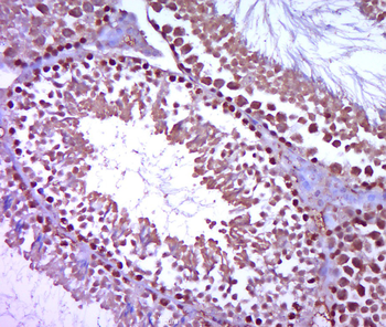 Plzf Rabbit Polyclonal Antibody
