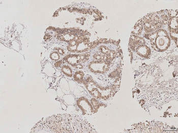 AQP2 Rabbit Polyclonal Antibody