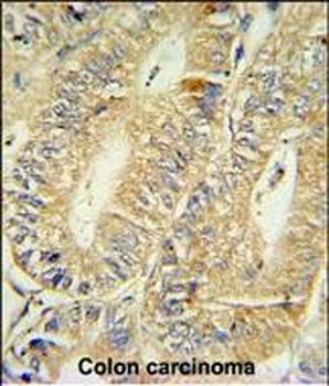 HPGD Rabbit Polyclonal Antibody