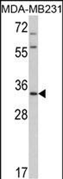 HPGD Rabbit Polyclonal Antibody