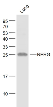 RERG Rabbit Polyclonal Antibody