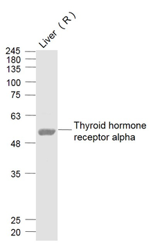 Thyroid hormone receptor alpha Rabbit Polyclonal Antibody