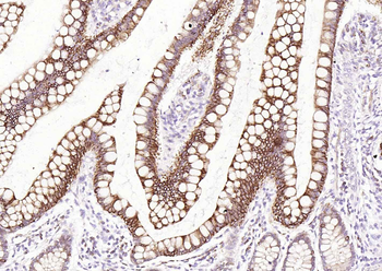 TSPAN8 Rabbit Polyclonal Antibody