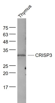 CRISP3 Rabbit Polyclonal Antibody