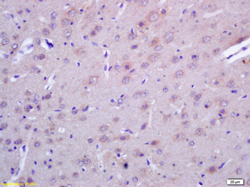 ACTH (1-39) Rabbit Polyclonal Antibody