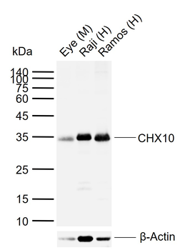 CHX10 Rabbit Polyclonal Antibody