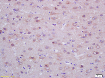ACTH (18-39) Rabbit Polyclonal Antibody