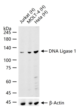 DNA Ligase 1 Rabbit Polyclonal Antibody