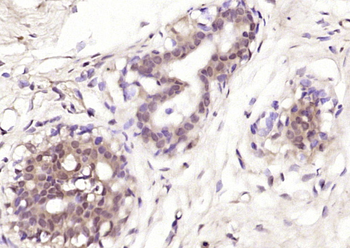 DNA Ligase 1 Rabbit Polyclonal Antibody