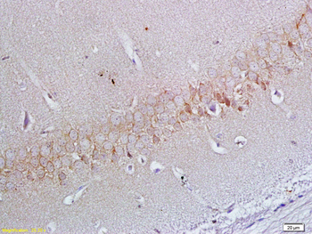 ApoER2 Rabbit Polyclonal Antibody