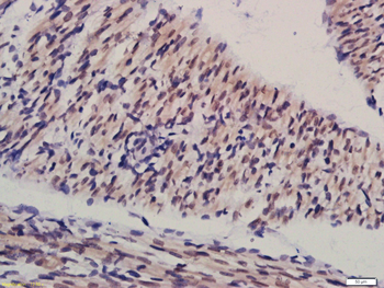 Sertad1 Rabbit Polyclonal Antibody