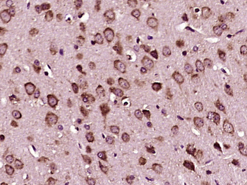 ASC/TMS1 Rabbit Polyclonal Antibody