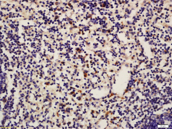 ASC/TMS1 Rabbit Polyclonal Antibody