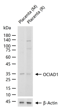 OCIAD1 Rabbit Polyclonal Antibody