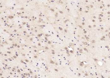 OCIAD1 Rabbit Polyclonal Antibody