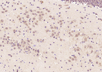 OCIAD1 Rabbit Polyclonal Antibody