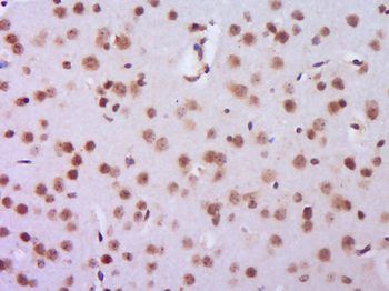 MAP3K2 Rabbit Polyclonal Antibody