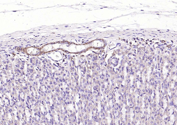 Alpha smooth muscle Actin Rabbit Polyclonal Antibody