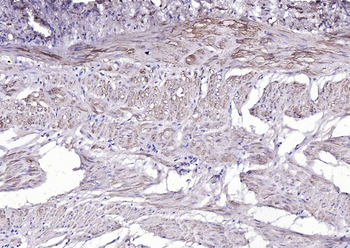 Alpha smooth muscle Actin Rabbit Polyclonal Antibody