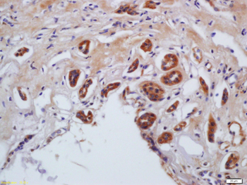 Myosin light chain (phospho S20) Rabbit Polyclonal Antibody