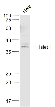 Islet 1 Rabbit Polyclonal Antibody